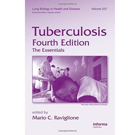 Tuberculosis: The Essentials, Fourth Edition