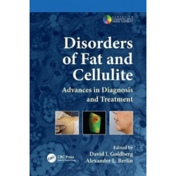 Disorders of Fat and Cellulite: Advances in Diagnosis and Treatment