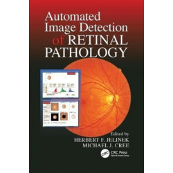 Automated Image Detection of Retinal Pathology
