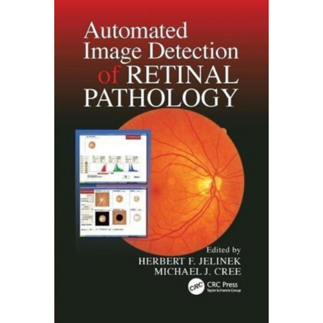 Automated Image Detection of Retinal Pathology