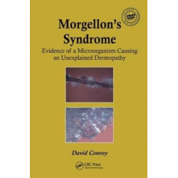 Morgellon's Syndrome: Evidence of a Microorganism Causing an Unexplained Dermopathy