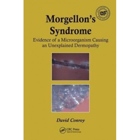Morgellon's Syndrome: Evidence of a Microorganism Causing an Unexplained Dermopathy