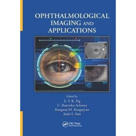 Ophthalmological Imaging and Applications