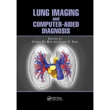 Lung Imaging and Computer Aided Diagnosis