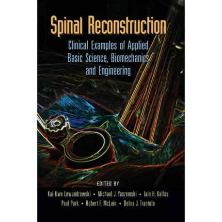 Spinal Reconstruction: Clinical Examples of Applied Basic Science, Biomechanics and Engineering