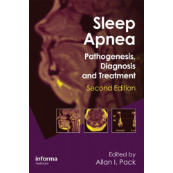Sleep Apnea: Pathogenesis, Diagnosis and Treatment