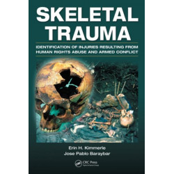 Skeletal Trauma: Identification of Injuries Resulting from Human Rights Abuse and Armed Conflict