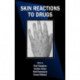 Skin Reactions to Drugs