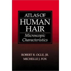Atlas of Human Hair: Microscopic Characteristics