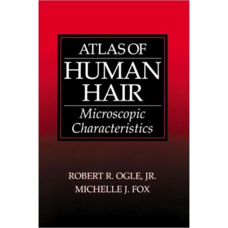 Atlas of Human Hair: Microscopic Characteristics
