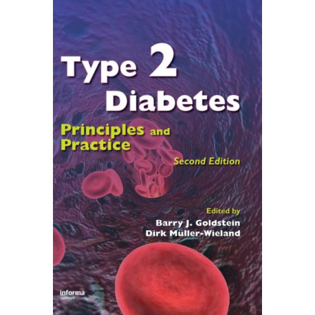 Type 2 Diabetes: Principles and Practice, Second Edition