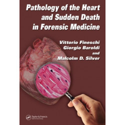 Pathology of the Heart and Sudden Death in Forensic Medicine