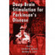 Deep Brain Stimulation for Parkinson's Disease