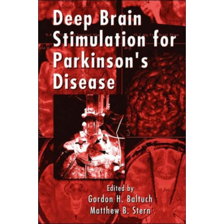 Deep Brain Stimulation for Parkinson's Disease