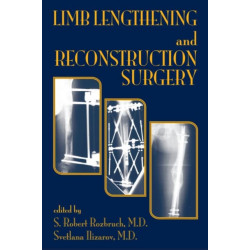Limb Lengthening and Reconstruction Surgery