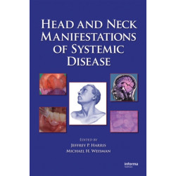 Head and Neck Manifestations of Systemic Disease