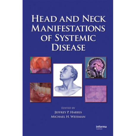 Head and Neck Manifestations of Systemic Disease