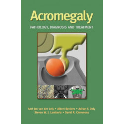 Acromegaly: Pathology, Diagnosis and Treatment