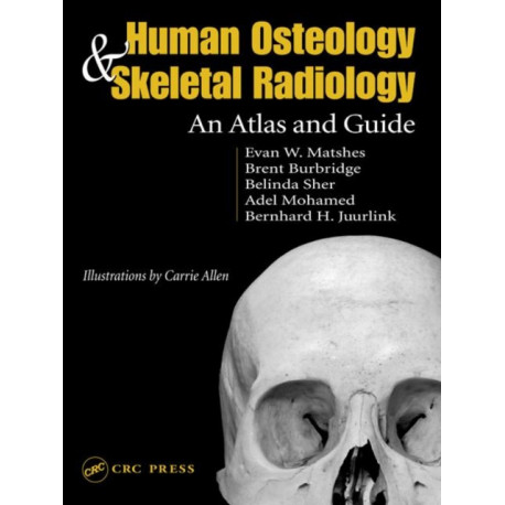 Human Osteology and Skeletal Radiology: An Atlas and Guide