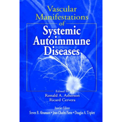 Vascular Manifestations of Systemic Autoimmune Diseases