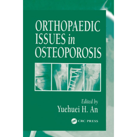Orthopaedic Issues in Osteoporosis
