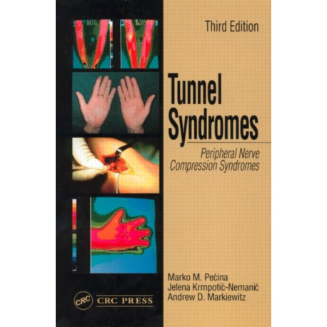 Tunnel Syndromes