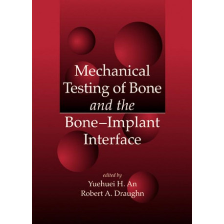 Mechanical Testing of Bone and the Bone-Implant Interface
