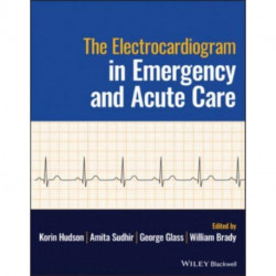 The Electrocardiogram in Emergency and Acute Care