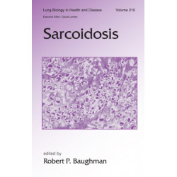 Sarcoidosis