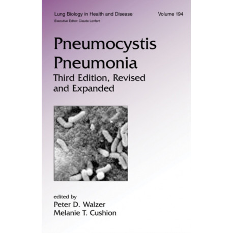Pneumocystis Pneumonia