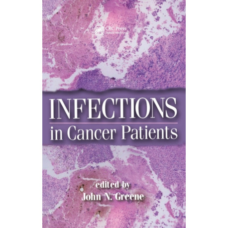 Infections in Cancer Patients