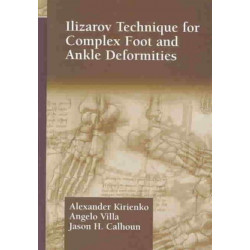 Ilizarov Technique for Complex Foot and Ankle Deformities