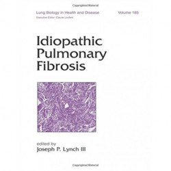 Idiopathic Pulmonary Fibrosis