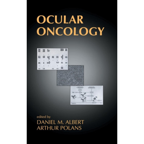 Ocular Oncology