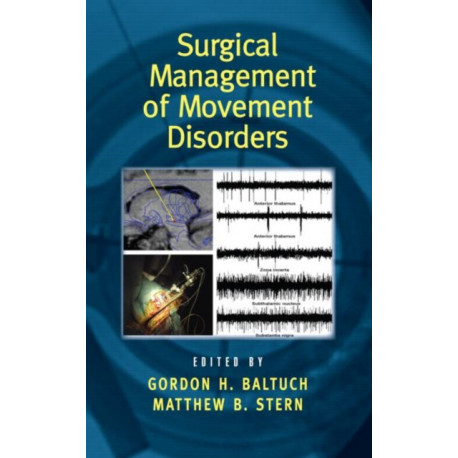Surgical Management of Movement Disorders