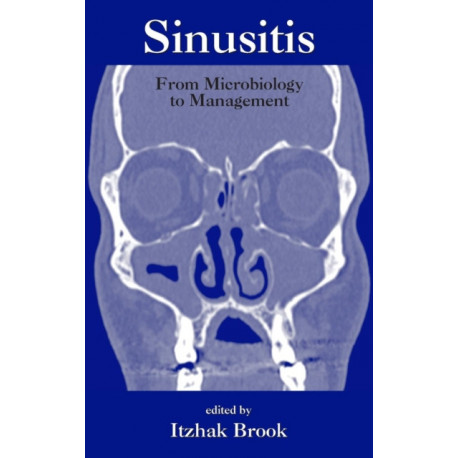 Sinusitis: From Microbiology To Management