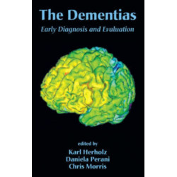The Dementias: Early Diagnosis and Evaluation