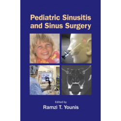 Pediatric Sinusitis and Sinus Surgery