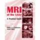 MRI of the Liver: A Practical Guide