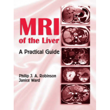 MRI of the Liver: A Practical Guide