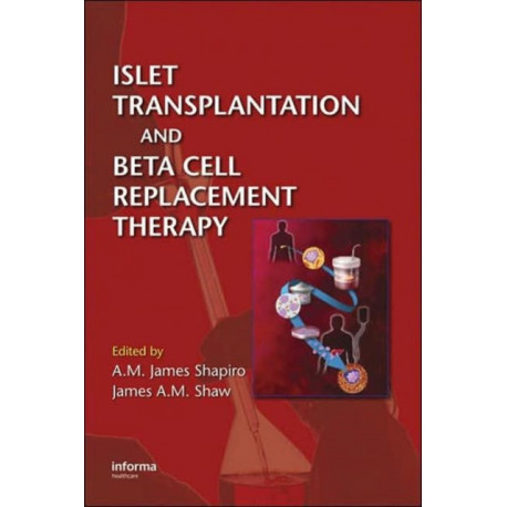 Islet Transplantation and Beta Cell Replacement Therapy