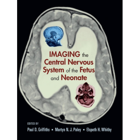 Imaging the Central Nervous System of the Fetus and Neonate
