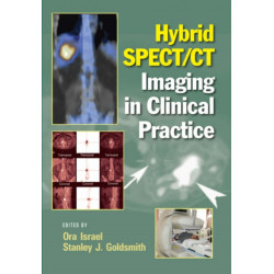 Hybrid SPECT/CT Imaging in Clinical Practice