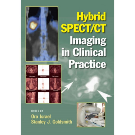 Hybrid SPECT/CT Imaging in Clinical Practice