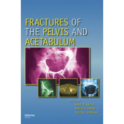Fractures of the Pelvis and Acetabulum