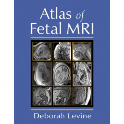 Atlas of Fetal MRI