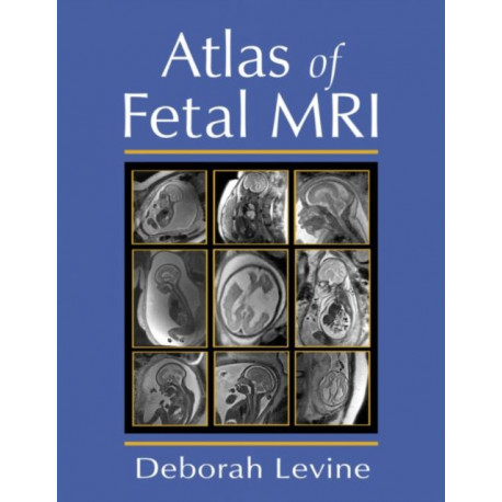 Atlas of Fetal MRI
