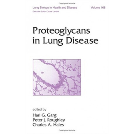 Proteoglycans in Lung Disease
