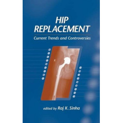Hip Replacement: Current Trends and Controversies
