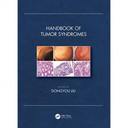 Handbook of Tumor Syndromes